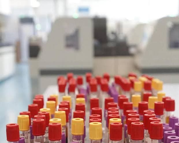 A Francoforte, otto casi di malaria: tre decessi vicino all'aeroporto
